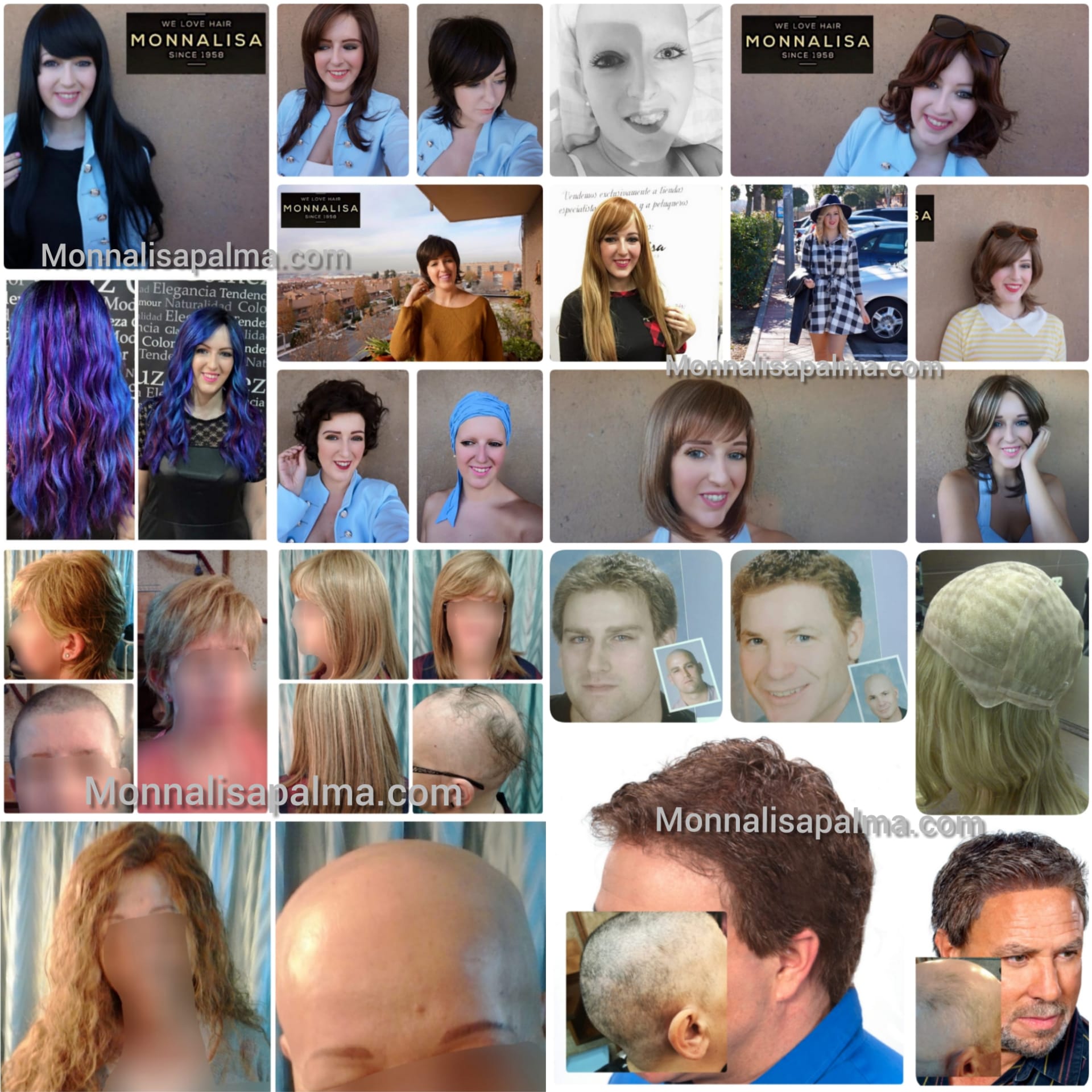 foto-alopecia-monna-lisa-palma-1
